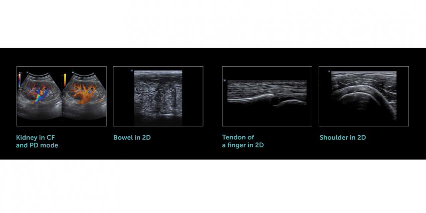 Improved diagnostics