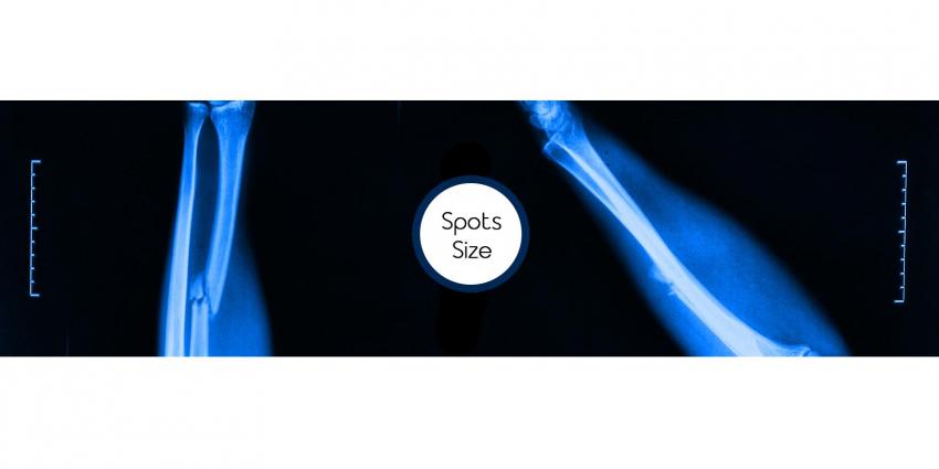 Focal spots size — BiMedis Focal spots size