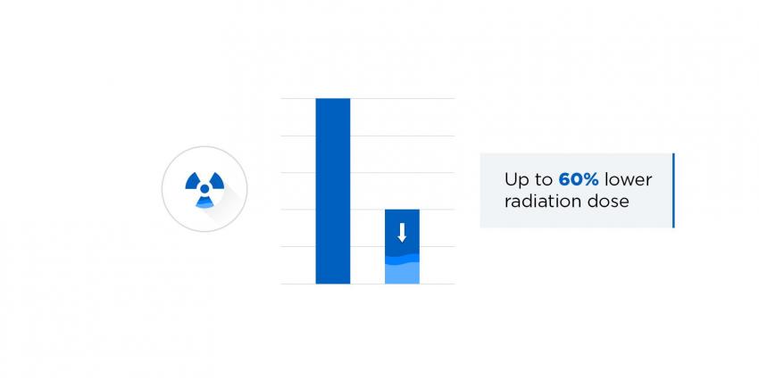 SAFIRE algorithm reduces radiation dose by 60%