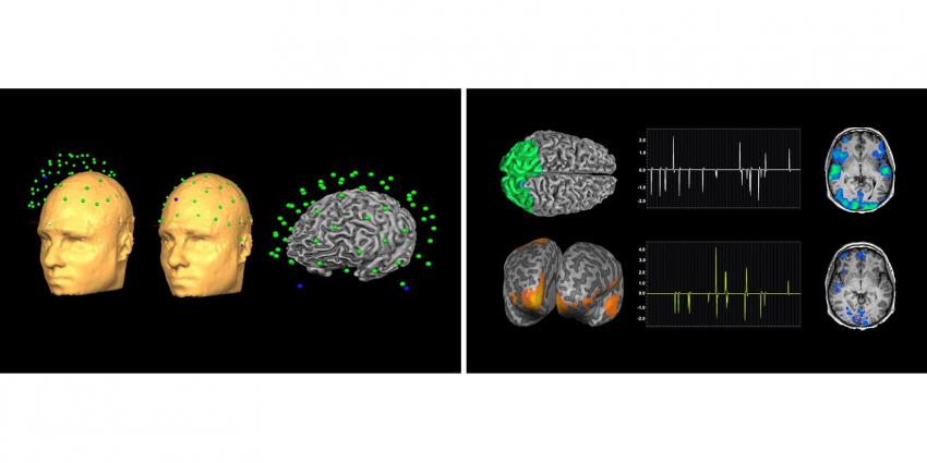 A new visualization platform