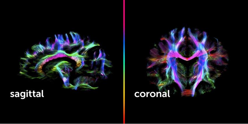 Advantages of the MRI scanner